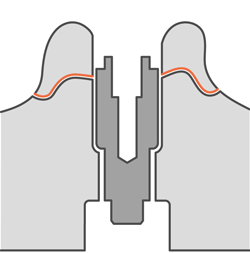 250 3.ModelDieWithBoreProcessorControl.ModelGingivaMaskImplantTopOffset.gif