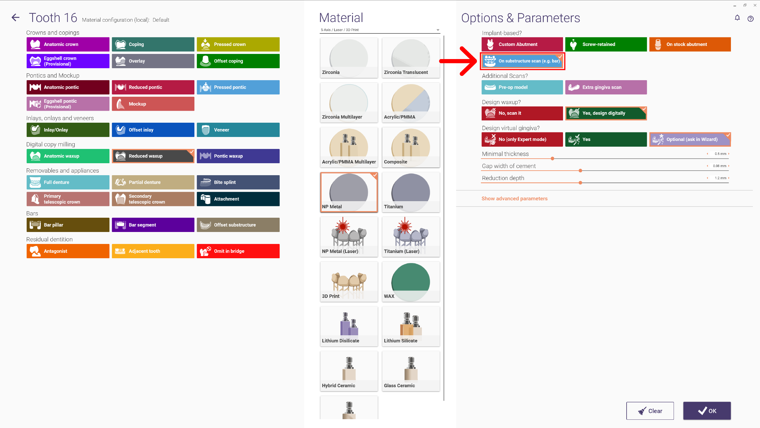 DentalDB Substructure 3.1.png