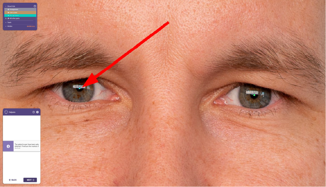 Click the right eye.png