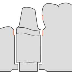 250 5.ModelDieWithBoreProcessorControl.ModelDitchWidth.gif