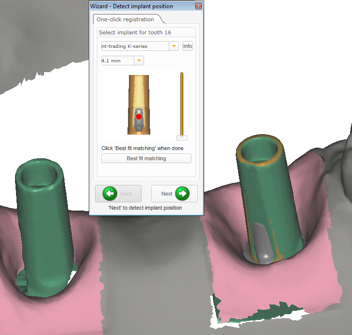 Cust abutment detect implant position svg.png