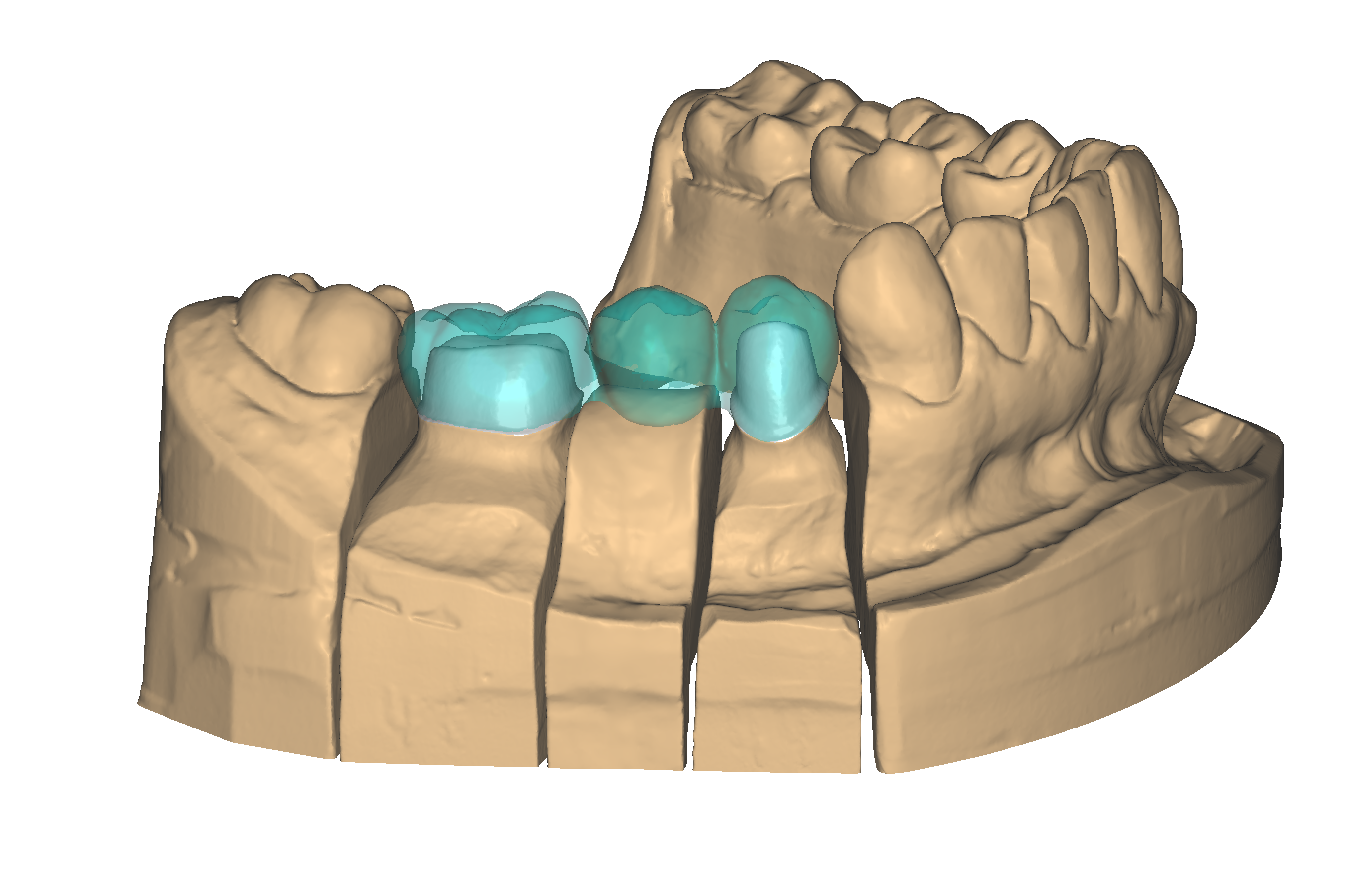 Pre-op1.png