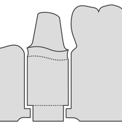 250 4.ModelDieWithBoreProcessorControl.ModelDitchWidthCheckbox.gif