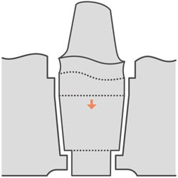 250 5.ModelDieWithBoreProcessorControl.ModelDieShaftTaperHeightLimit.gif
