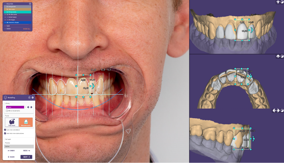 View the dimensions of a tooth.png