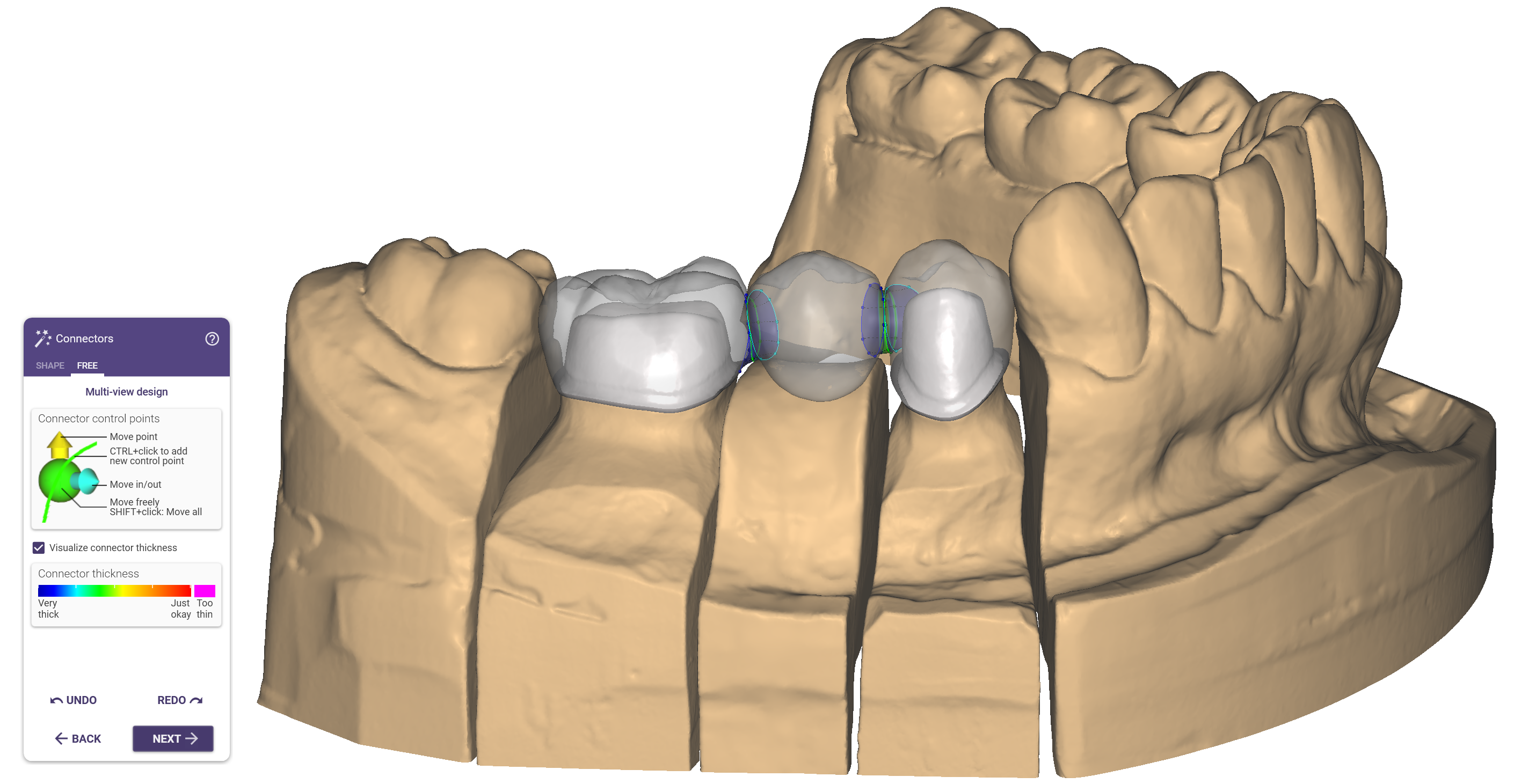 Pre-op7.png