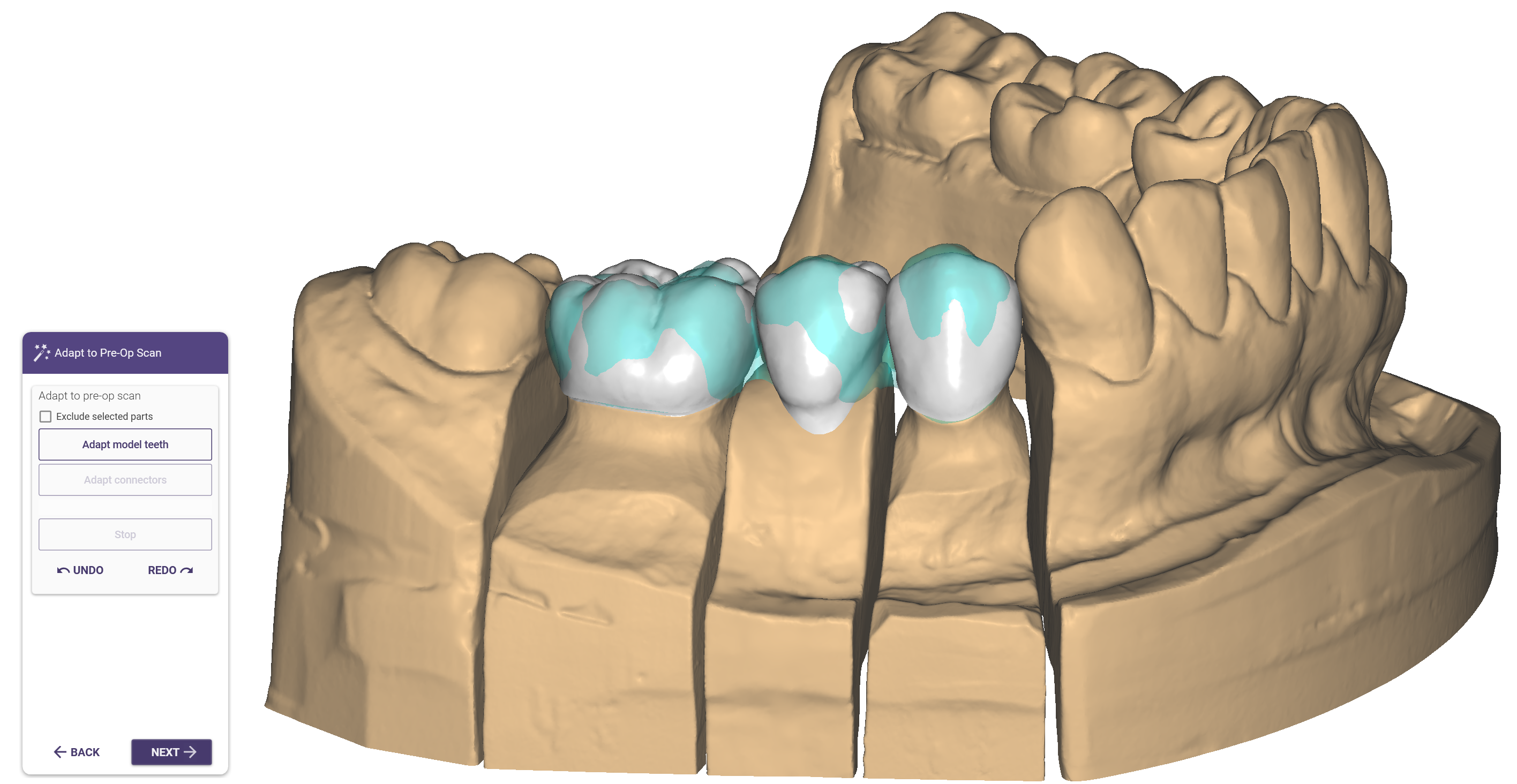 Pre-op4.png