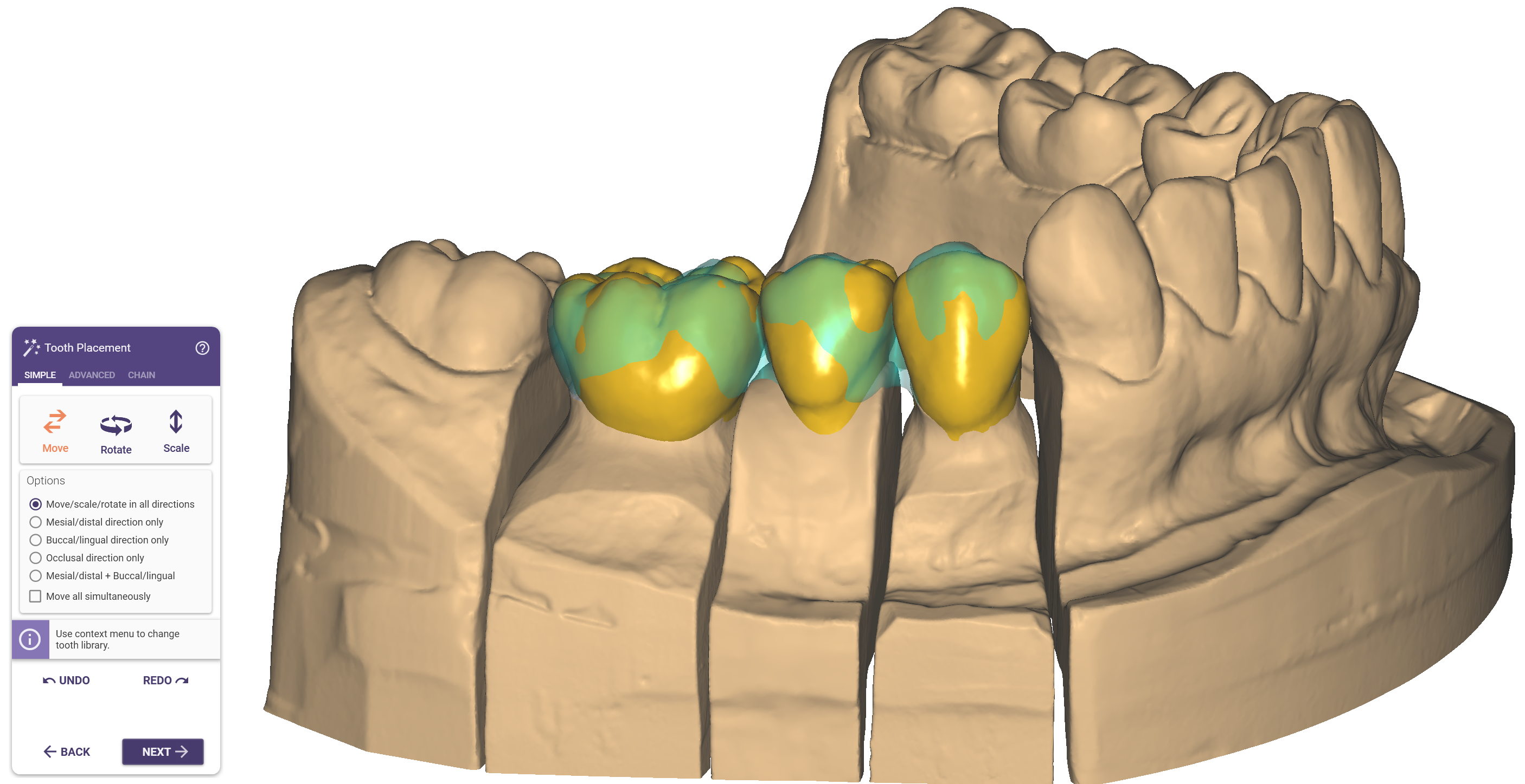 Pre-op2.png