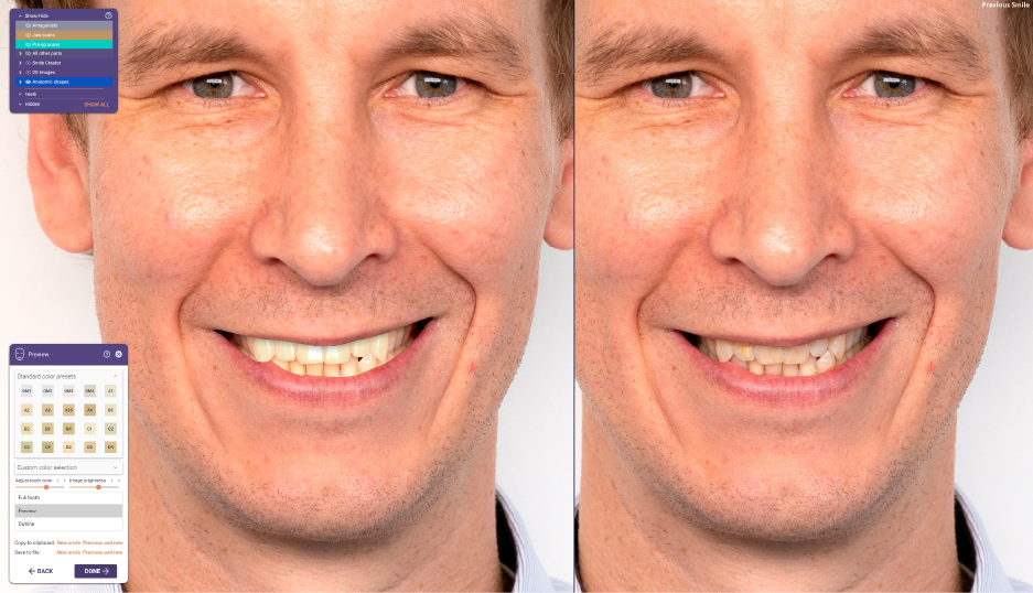 Smile preview.png