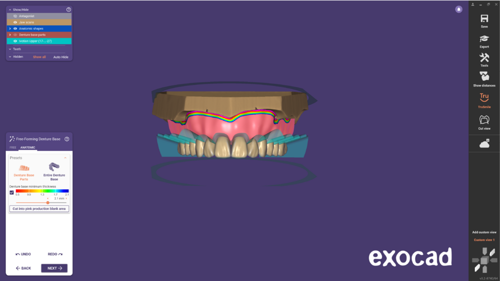 Ivotion dentalCAD-14.png