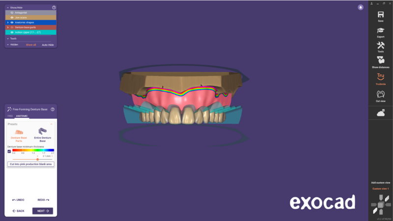File:Ivotion dentalCAD-14.png