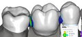 Thumbnail for version as of 15:27, 19 November 2010