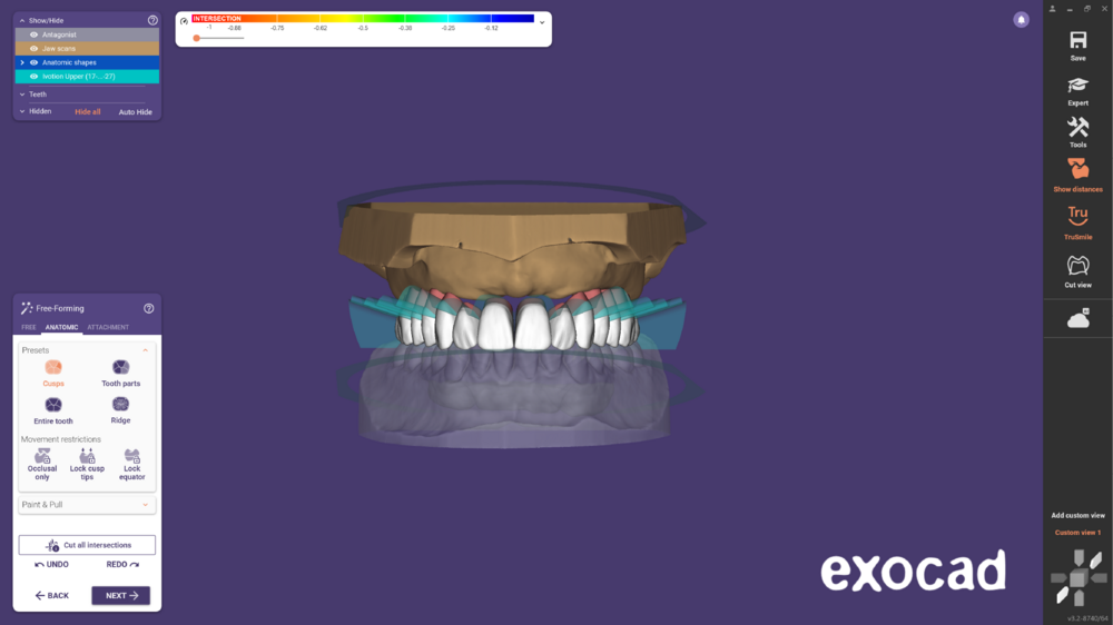 Ivotion dentalCAD-09.png
