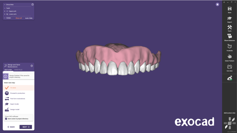 Duplicate denture -05.png