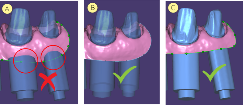 File:Gingiva tip.png