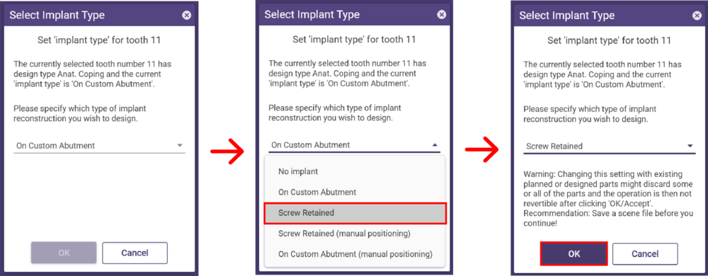 Select implant type 2.png