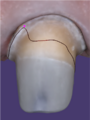 Thumbnail for version as of 18:47, 23 November 2023