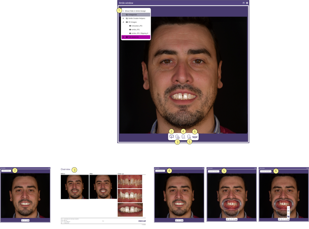 Smile window 4 3.2.png