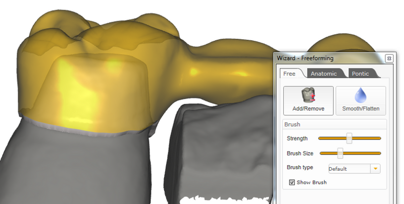 File:Waxup02.png