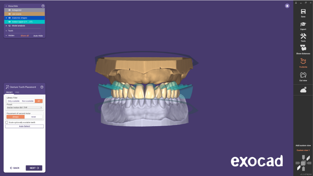 Ivotion dentalCAD-07.png