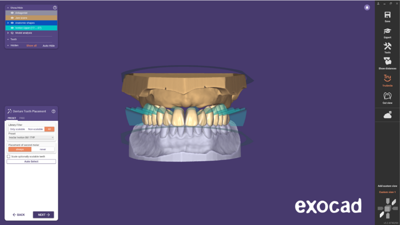 File:Ivotion dentalCAD-07.png