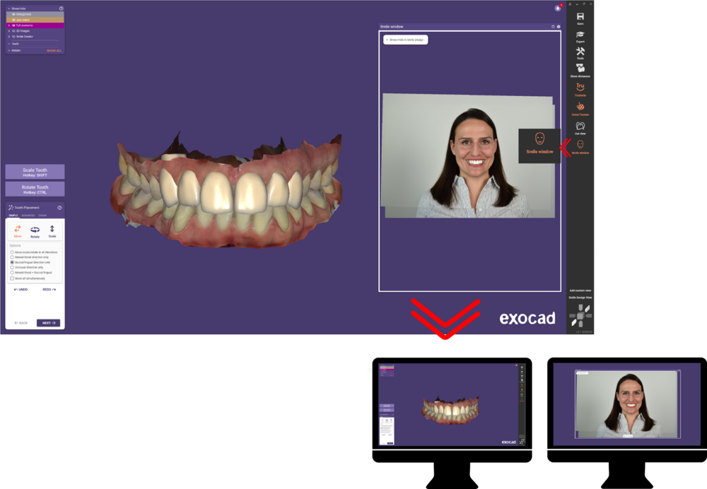 Smile window 3.1.png