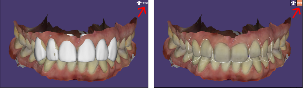 Full tooth viw 3.1.png