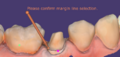 Thumbnail for version as of 09:14, 8 April 2022