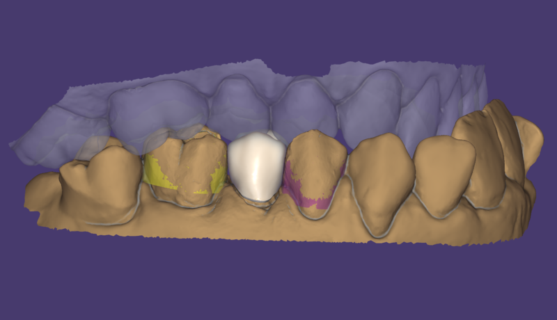 File:FreeFormingADAPTApprox-022.png
