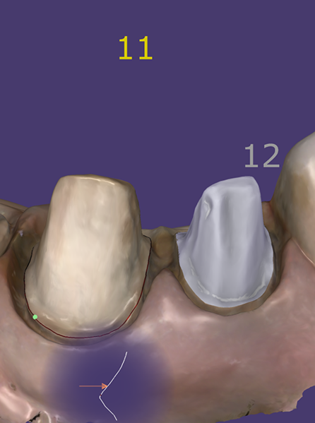 File:1bmargin a.png