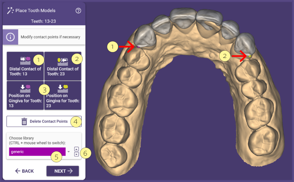 Place Tooth models 1a.PNG