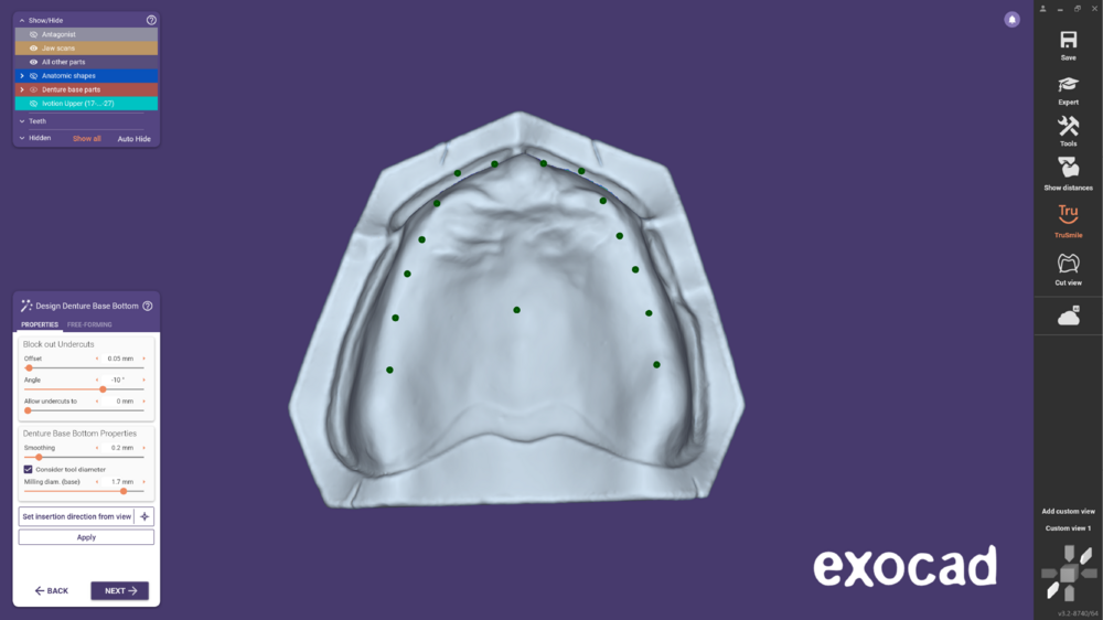 Ivotion dentalCAD-11.png