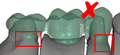 Thumbnail for version as of 14:22, 19 November 2010