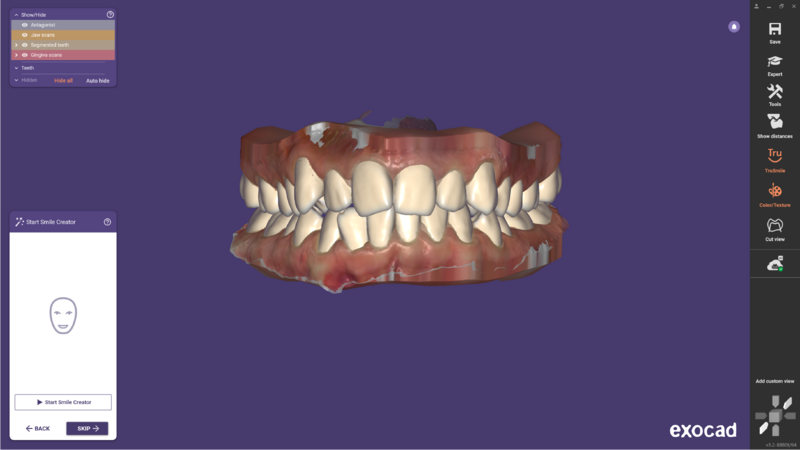 File:TruSmileVideo-4.png