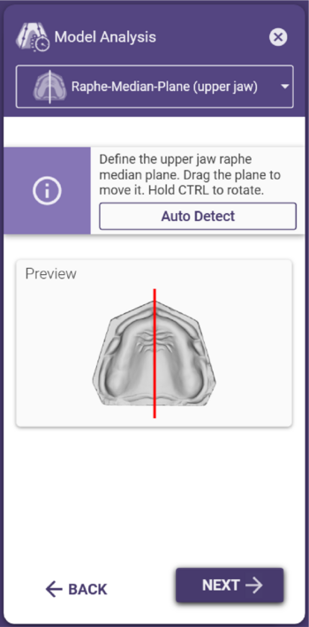 Model analysis median plane.png