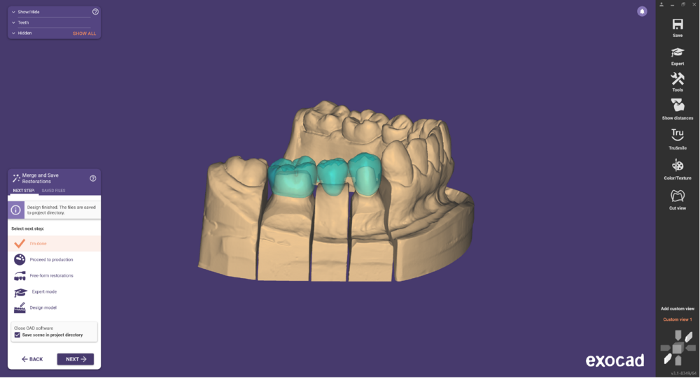 Pre-op-and-waxup-01.png