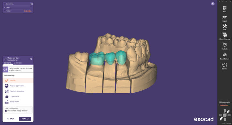 File:Pre-op-and-waxup-01.png