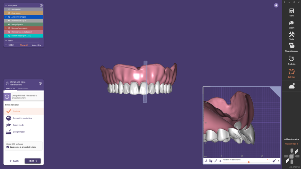 Ivotion dentalCAD-16.png