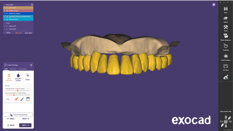 File:Duplicate denture-12.png