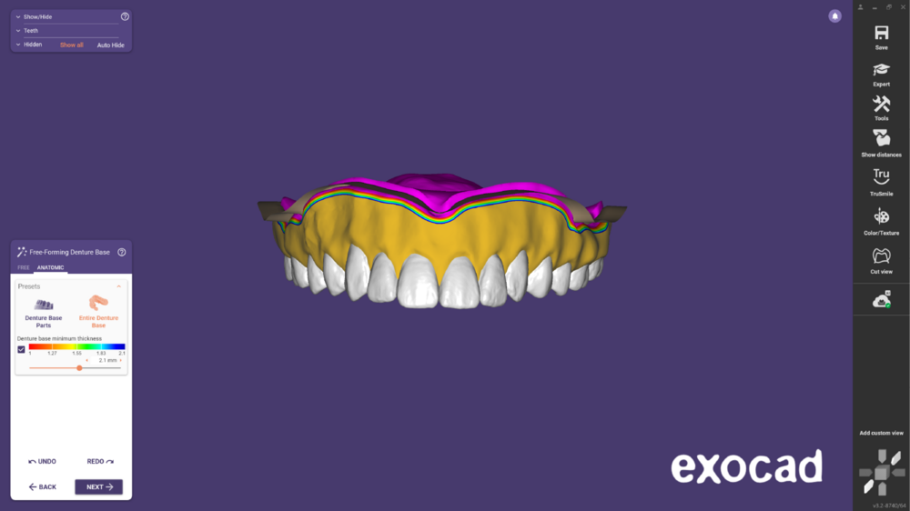 Duplicate denture -03.png
