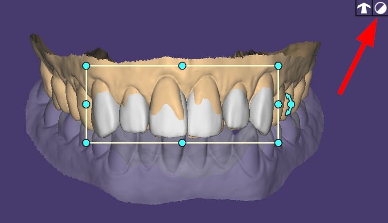File:Full tooth view.jpeg