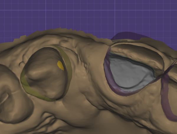 Exocad-support-192-1.png