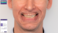 Thumbnail for version as of 10:17, 15 June 2021