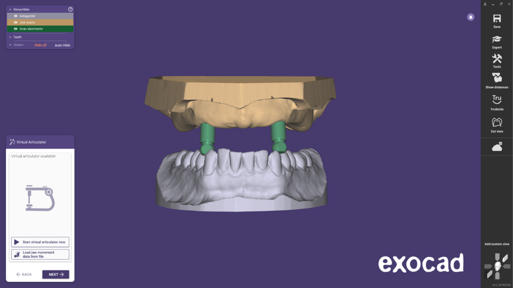 Ball attachment-01.png