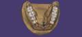 Thumbnail for version as of 11:14, 31 May 2021