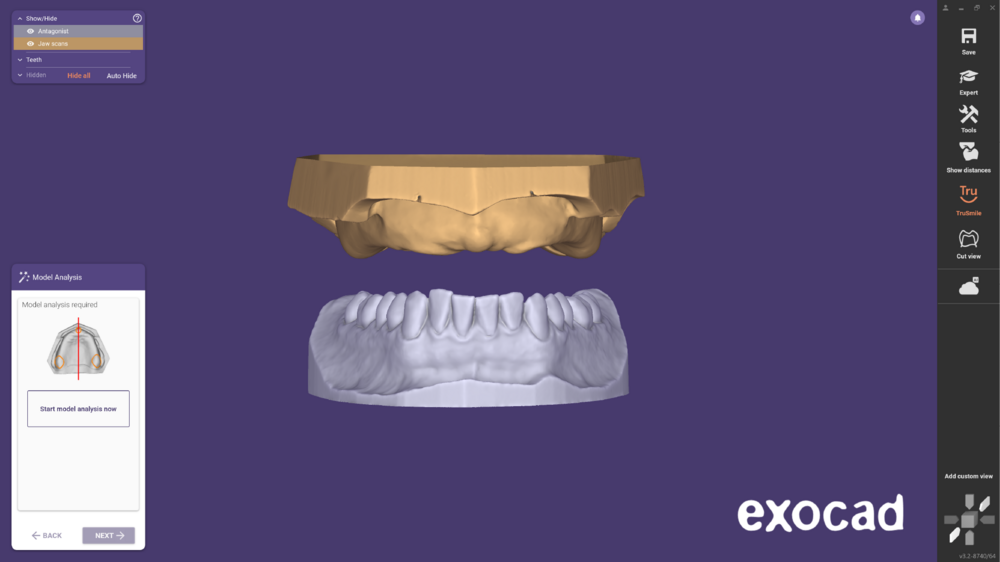 Ivotion dentalCAD-01.png