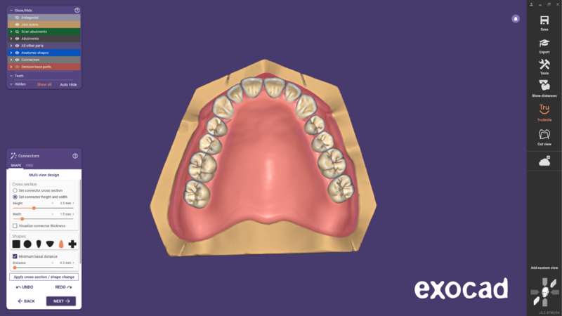 File:Ball attachment-09.png