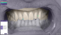 Thumbnail for version as of 10:15, 15 June 2021