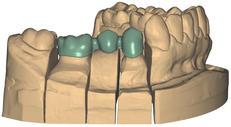 File:Wax up 3.png