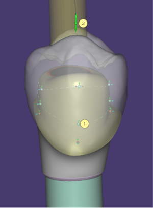 Abutment control.png